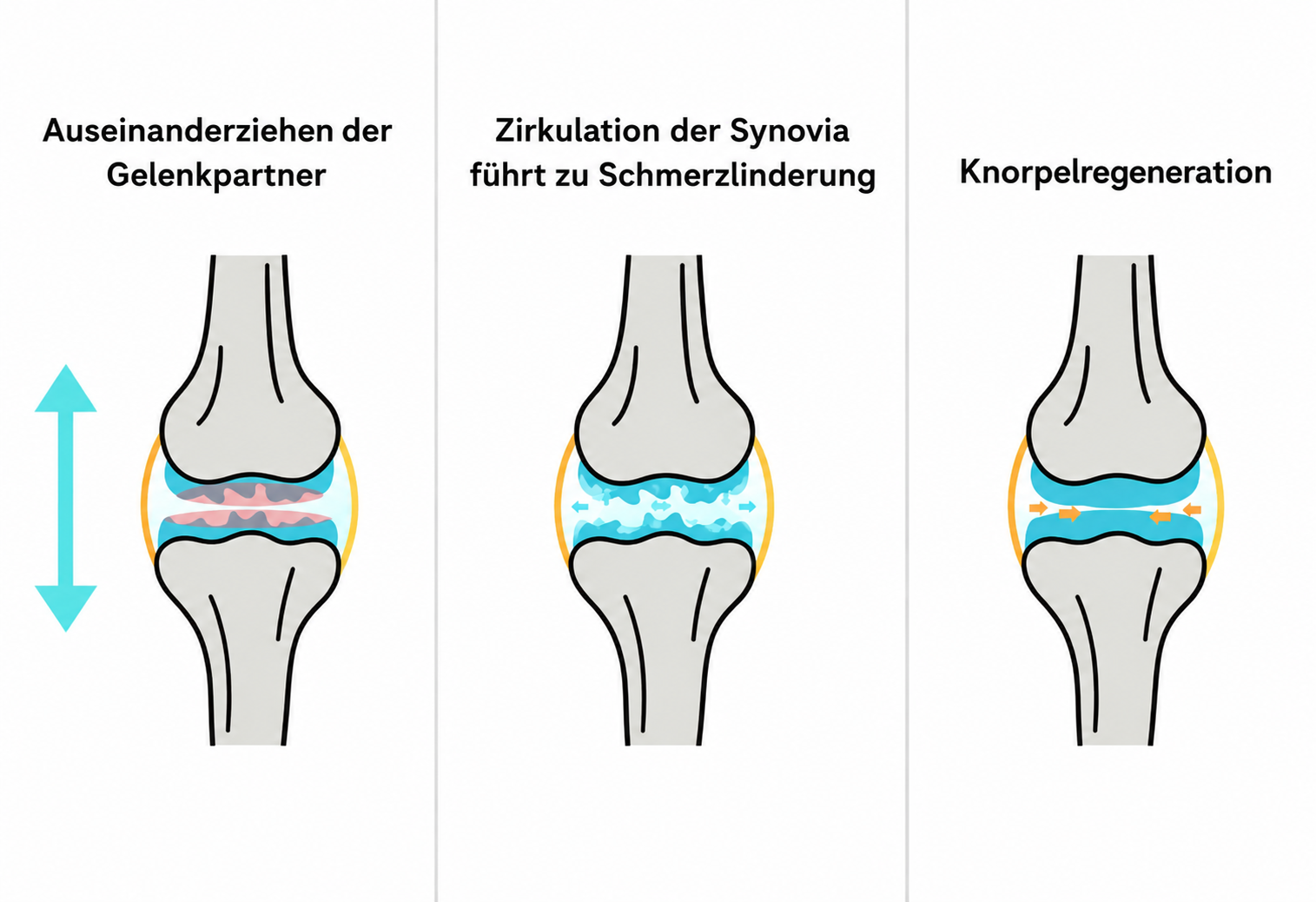 Gelenkdistraktion